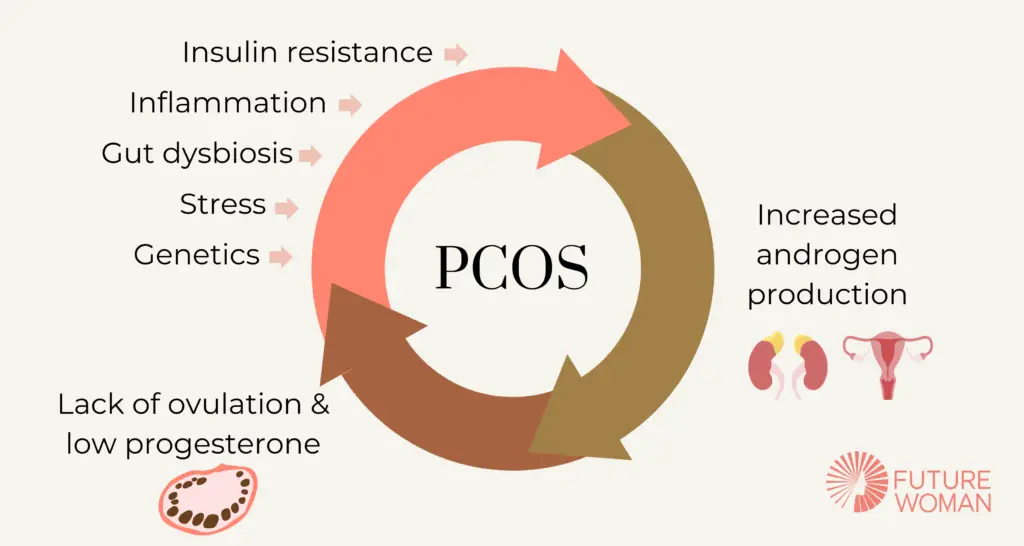 5 drivers of PCOS